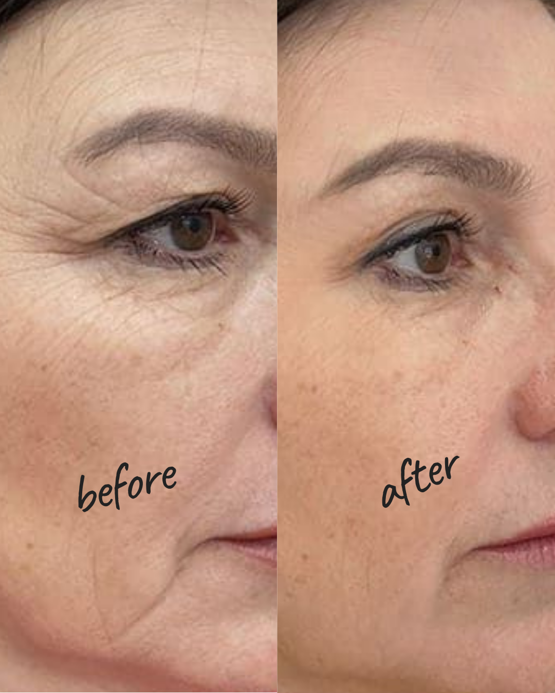 Before and after skincare NYC 1
